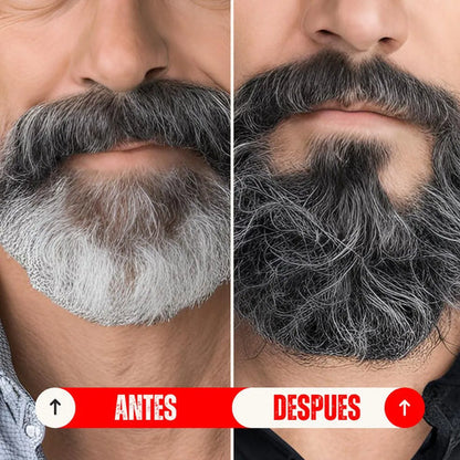 JABON CAPILAR ANTICANAS 2 x 1